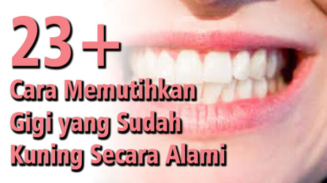 23+ Cara Memutihkan Gigi yang Sudah Kuning Secara Alami